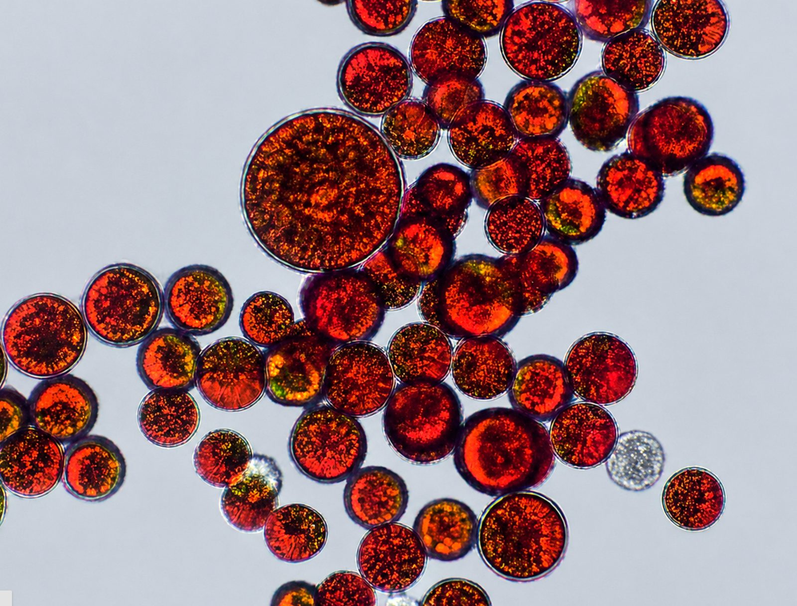 Astaxanthin microalgae under microscope